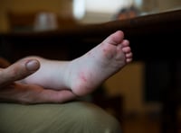 Hand, foot and mouth disease 'circulating in the Isle of Man' 