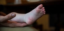 Hand, foot and mouth disease 'circulating in the Isle of Man' 