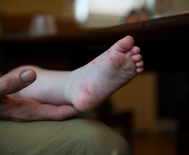 Hand, foot and mouth disease 'circulating in the Isle of Man' 